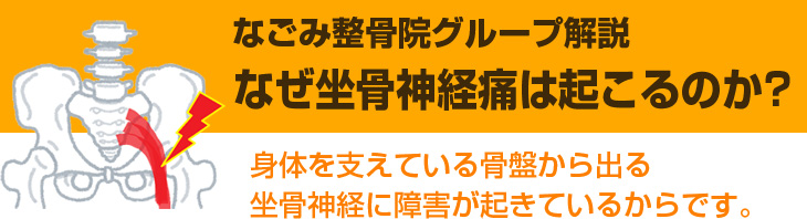 なぜ坐骨神経痛は起こるのか？