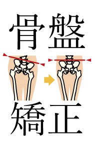 骨盤矯正