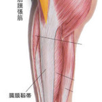 腸脛靭帯炎